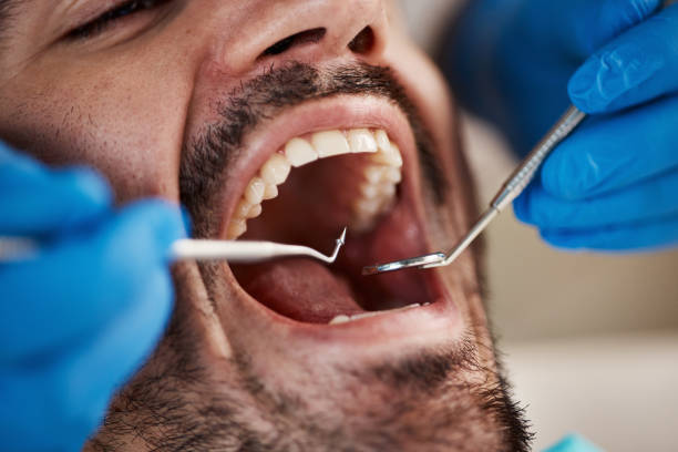 Best Broken or Chipped Tooth Repair in Mcconnell Af, KS